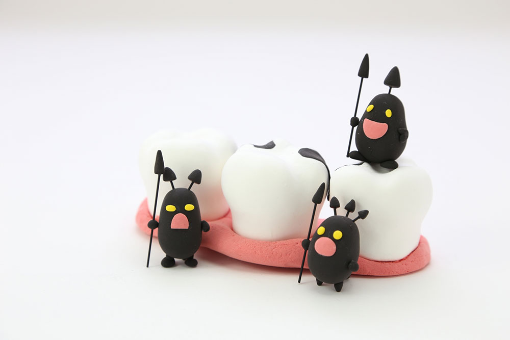 むし歯について