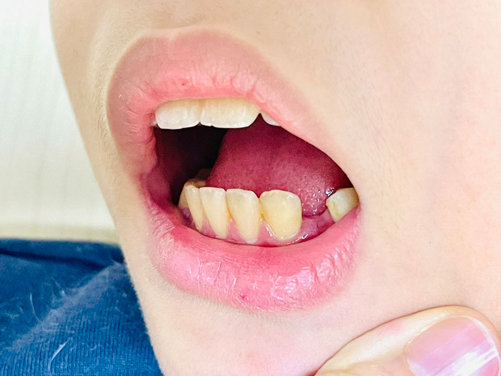 口腔外科について