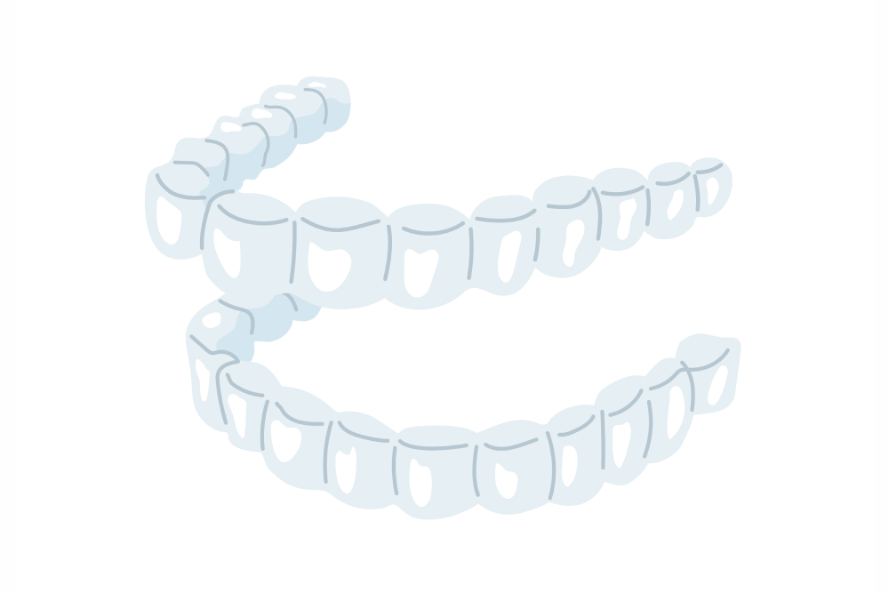 マウスピース矯正